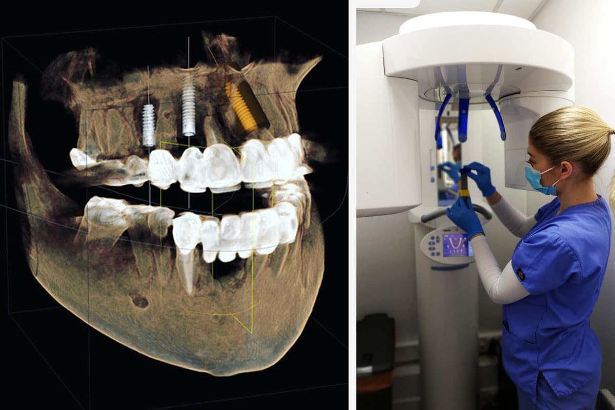 Dental CT Scans in Staines