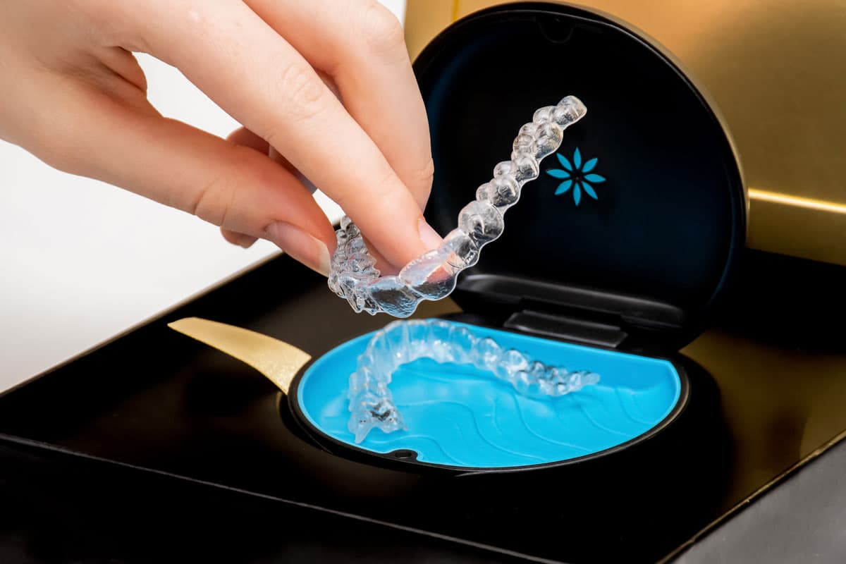 Removable Easy to Clean Aligners